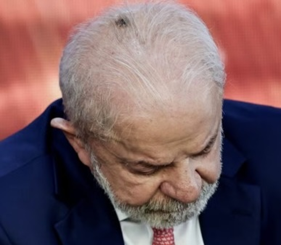 Lula fará procedimento na cabeça para remover mancha escura